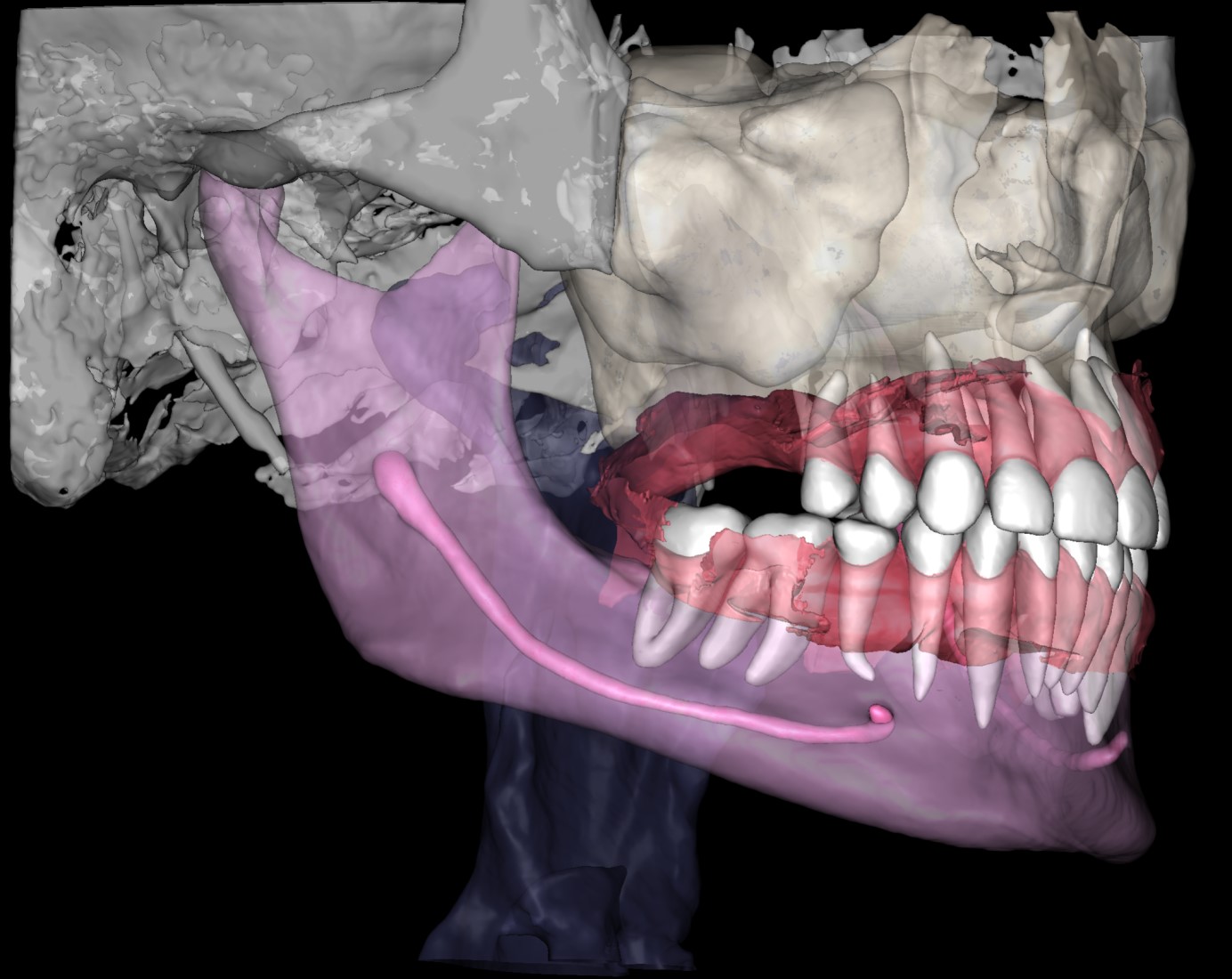 CBCT Segmentation 3 CBCT Segmentation 2