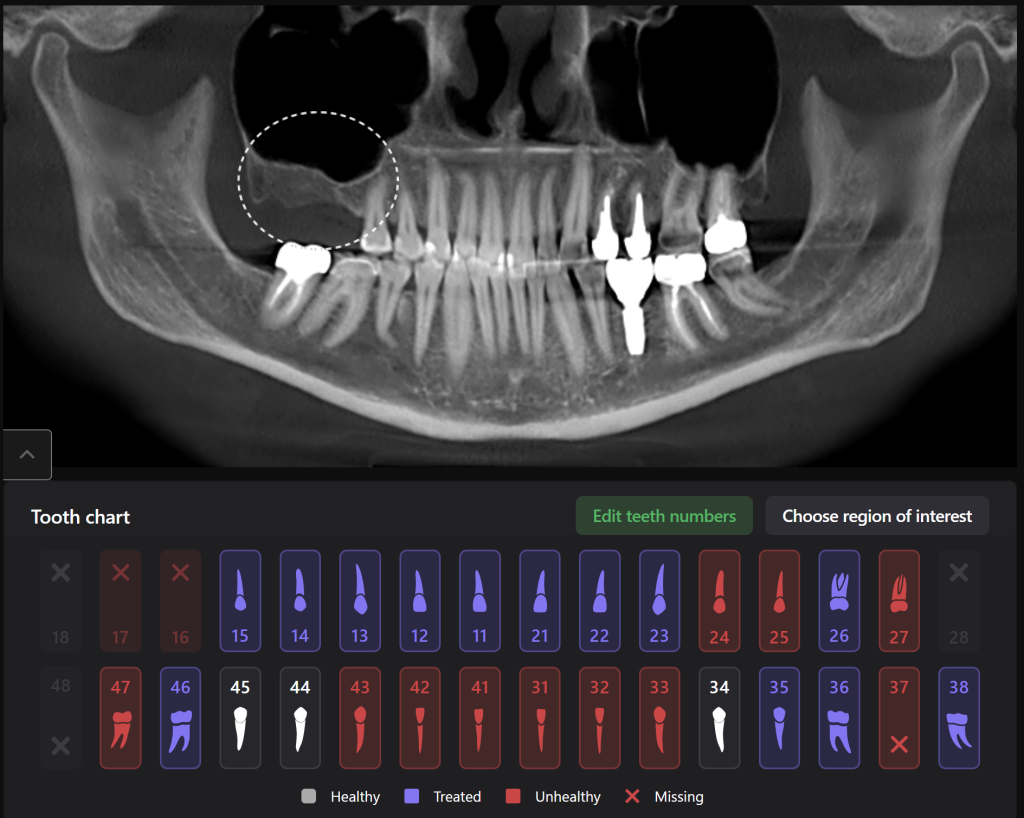 Implant treatment planning 2 Implant treatment planning 1