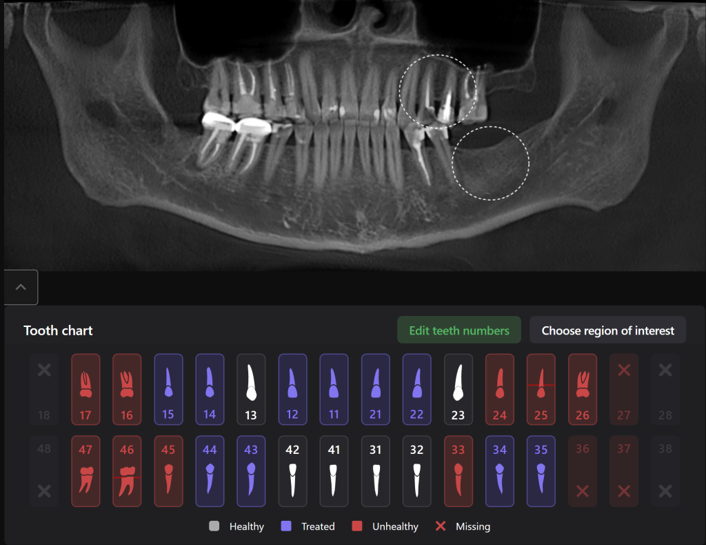 Implant placement using Diagnocat modules 2 Implant placement using Diagnocat modules 1