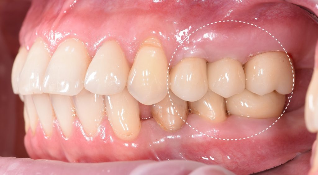 Implant placement using Diagnocat modules 20 Implant placement using Diagnocat modules 19