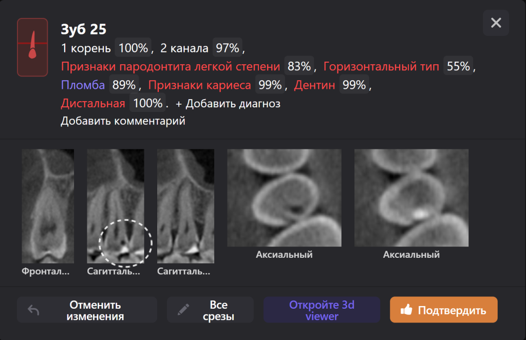 Diagnocat - ваш виртуальный ассистент стоматолога 4 Diagnocat - ваш виртуальный ассистент стоматолога 3