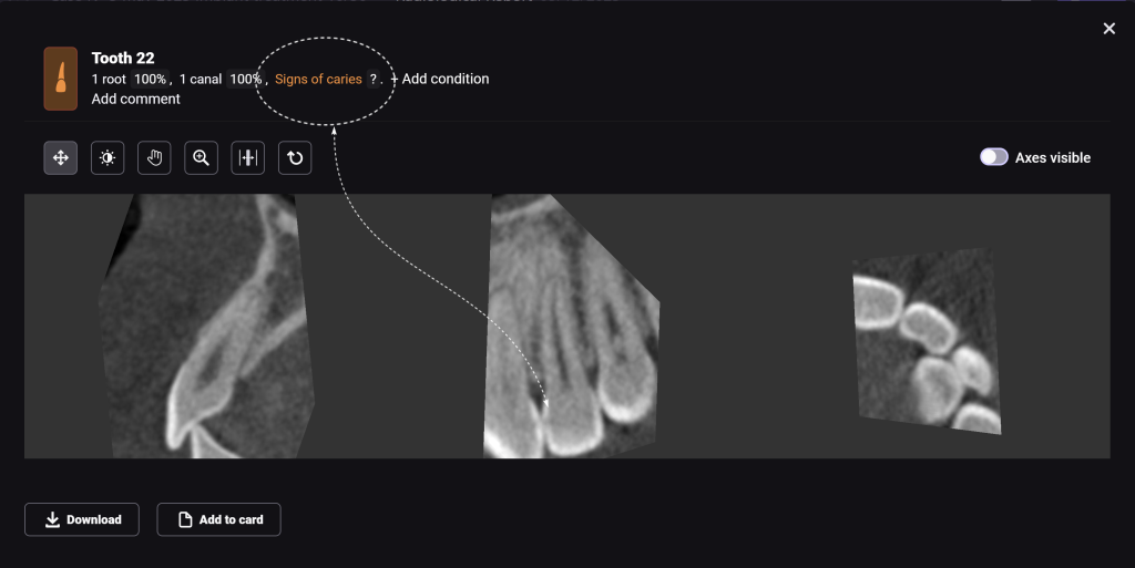 Diagnocat's radiological report - special features 4 Diagnocat's radiological report - special features 3