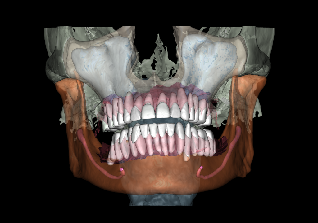 Коррекция розовой эстетики 4 Коррекция розовой эстетики 3