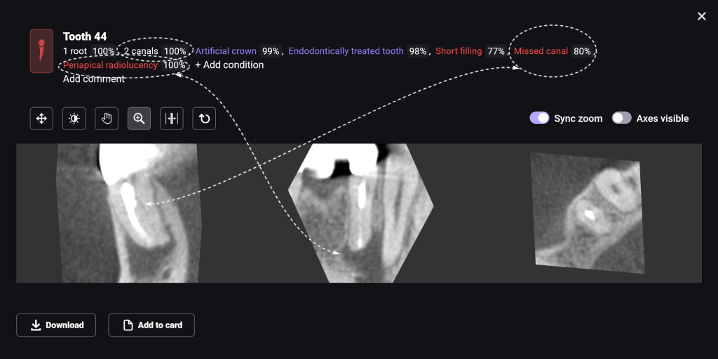 AI Diagnocat-supported case study 4 AI Diagnocat-supported case study 3
