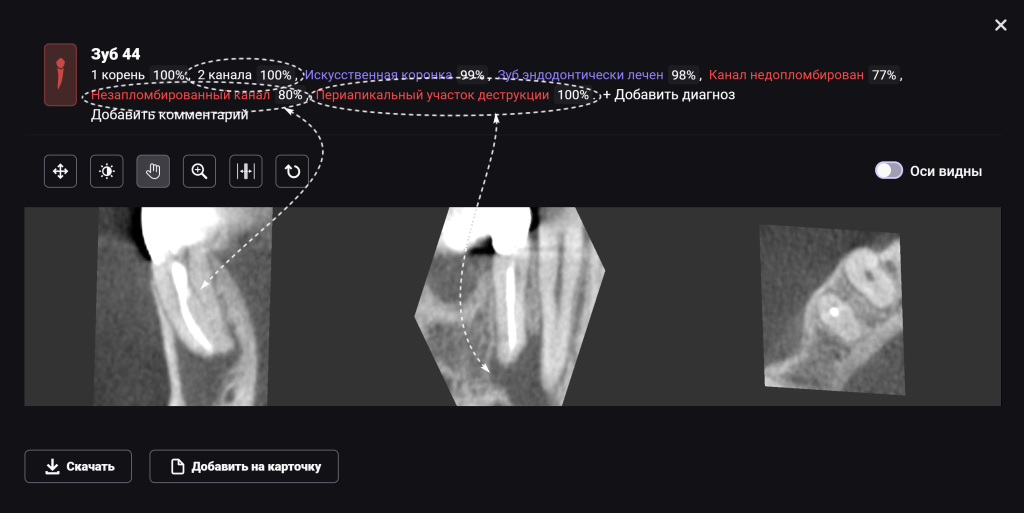 AI Diagnocat - помощник в планировании лечения 4 AI Diagnocat - помощник в планировании лечения 3