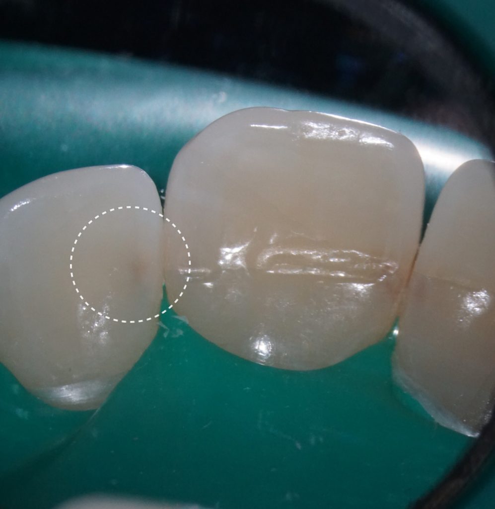 Рентгенологический отчет Diagnocat - особые возможности 6 Рентгенологический отчет Diagnocat - особые возможности 5