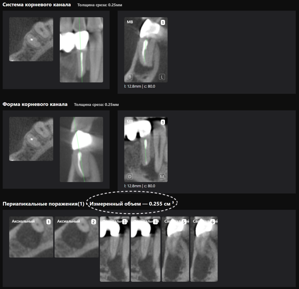 AI Diagnocat - помощник в планировании лечения 6 AI Diagnocat - помощник в планировании лечения 5