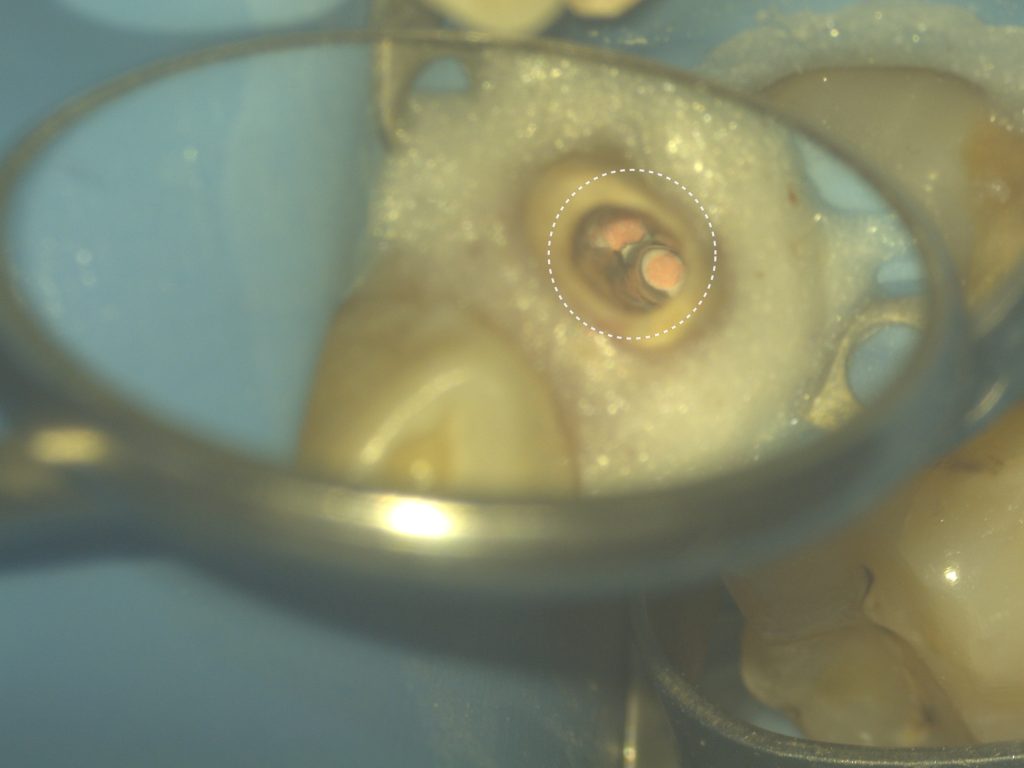 AI Diagnocat-supported case study 6 AI Diagnocat-supported case study 5