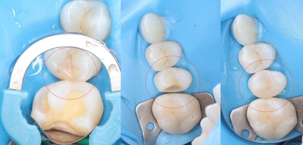 Diagnocat - your virtual dental assistant 6 Diagnocat - your virtual dental assistant 5