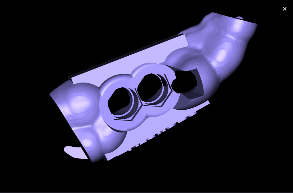 Implant placement using Diagnocat modules 8 Implant placement using Diagnocat modules 7