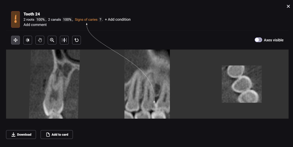 Diagnocat's radiological report - special features 8 Diagnocat's radiological report - special features 7