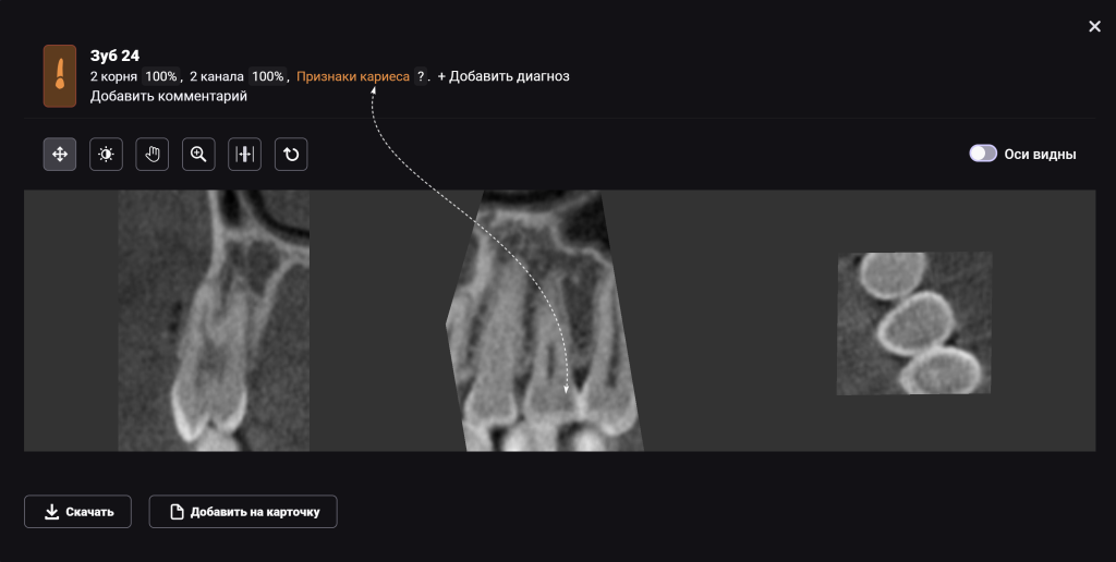 Рентгенологический отчет Diagnocat - особые возможности 8 Рентгенологический отчет Diagnocat - особые возможности 7