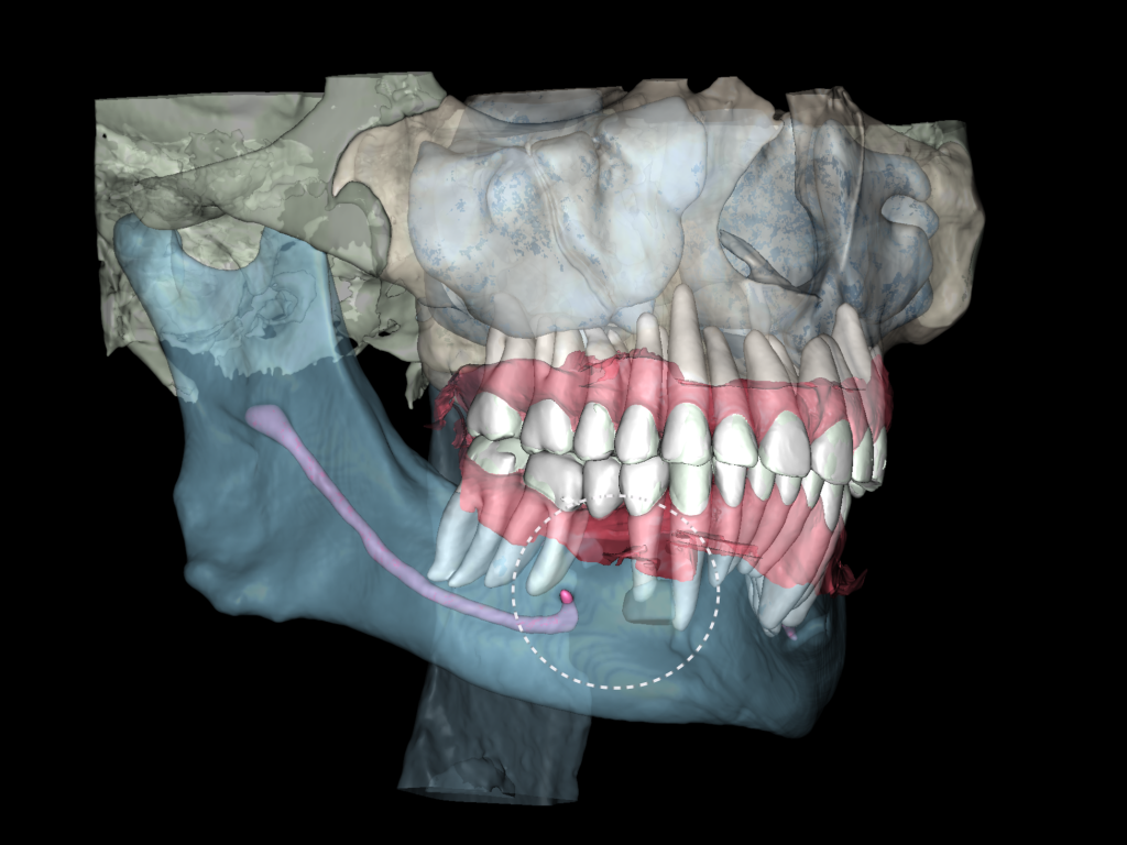 AI Diagnocat-supported case study 8 AI Diagnocat-supported case study 7