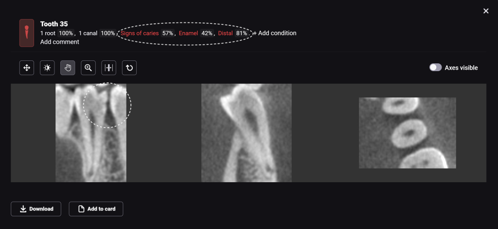Diagnocat - your virtual dental assistant 8 Diagnocat - your virtual dental assistant 7