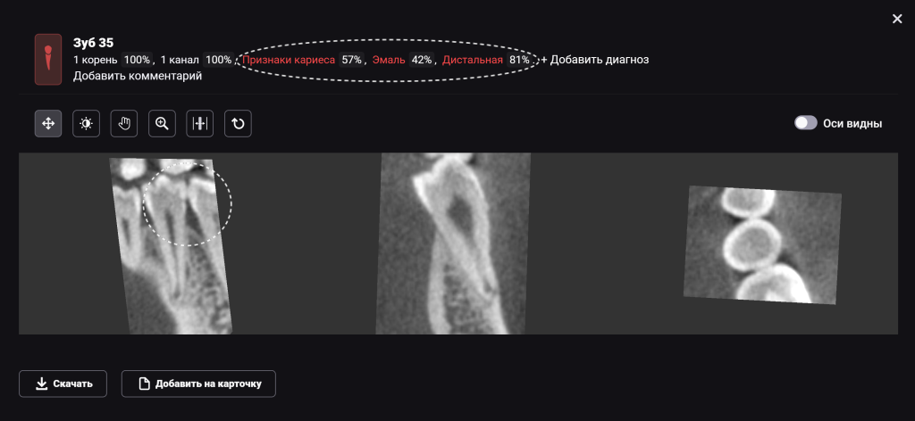 Diagnocat - ваш виртуальный ассистент стоматолога 8 Diagnocat - ваш виртуальный ассистент стоматолога 7