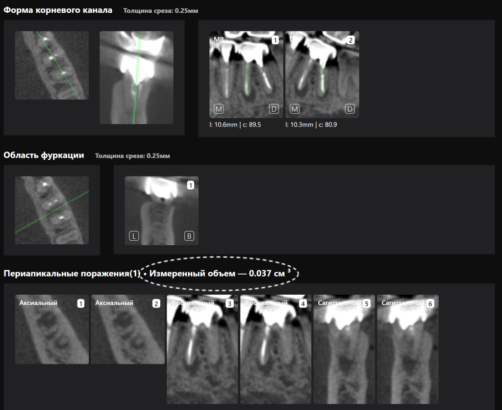 Случай из практики - планирование тотальной ортопедической реабилитации 10 Случай из практики - планирование тотальной ортопедической реабилитации 9