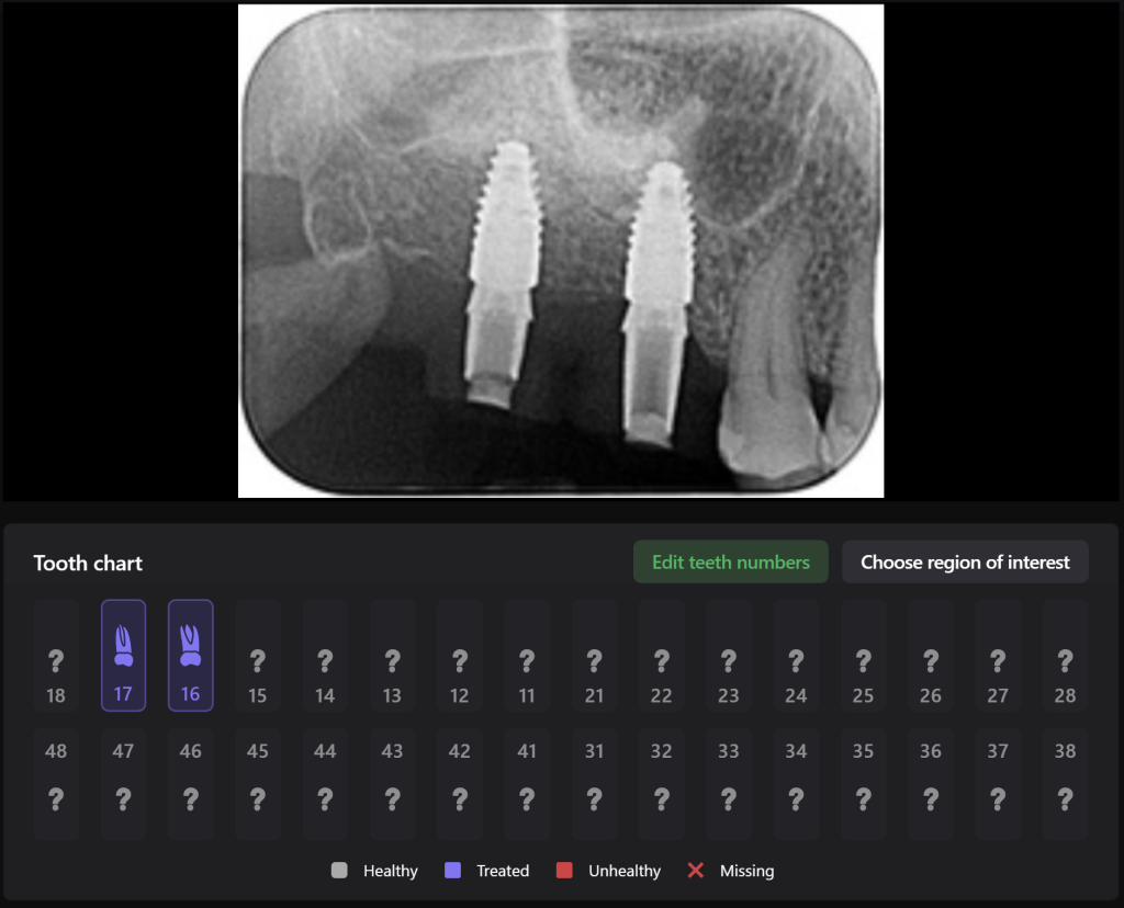 Implant treatment planning 10 Implant treatment planning 9