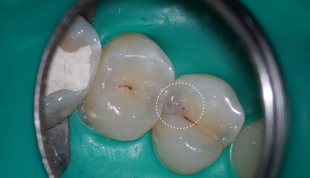 Diagnocat's radiological report - special features 10 Diagnocat's radiological report - special features 9