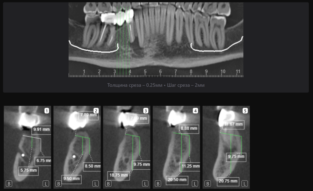 AI Diagnocat - помощник в планировании лечения 10 AI Diagnocat - помощник в планировании лечения 9