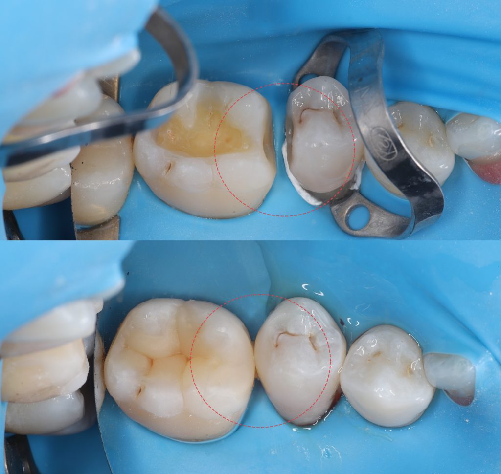 Diagnocat - your virtual dental assistant 10 Diagnocat - your virtual dental assistant 9