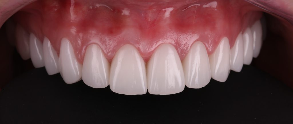 Correcting pink aesthetics 12 Correcting pink aesthetics 11