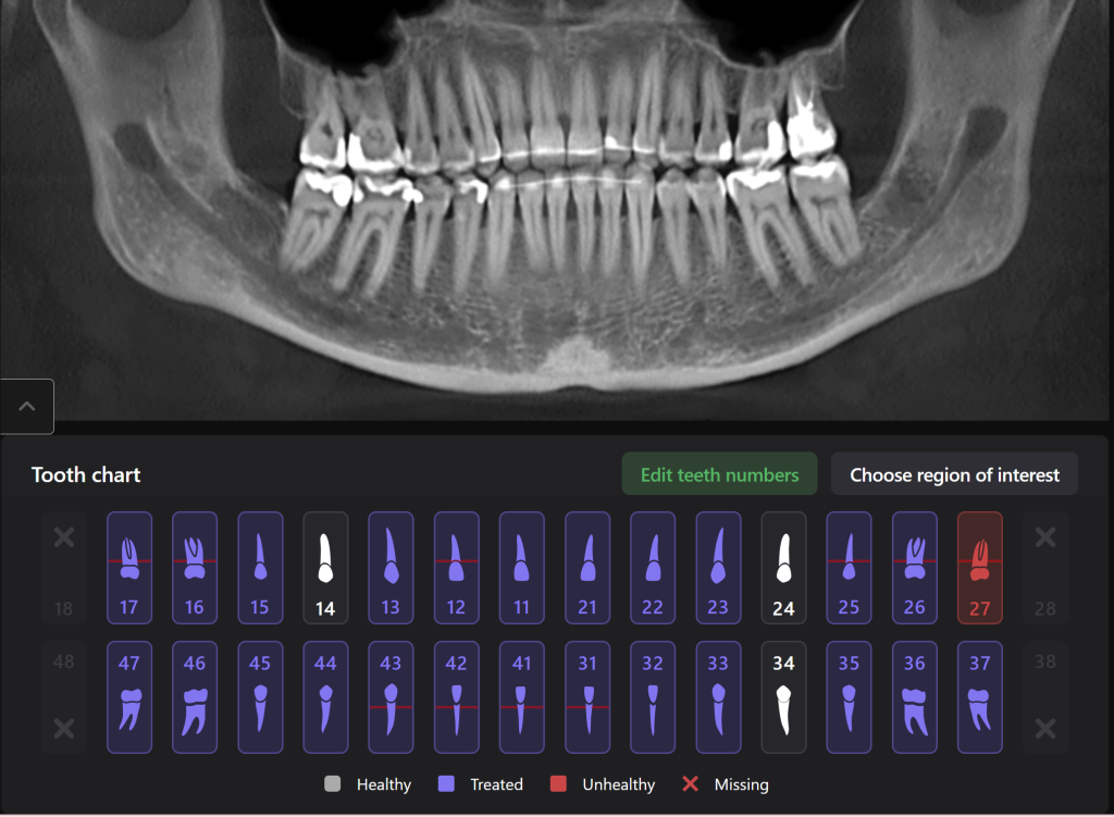 Diagnocat - your virtual dental assistant 12 Diagnocat - your virtual dental assistant 11