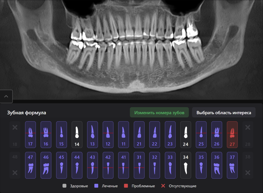 Diagnocat - ваш виртуальный ассистент стоматолога 12 Diagnocat - ваш виртуальный ассистент стоматолога 11