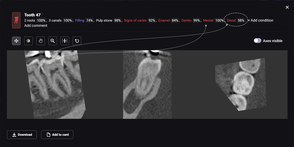 Diagnocat's radiological report - special features 12 Diagnocat's radiological report - special features 11