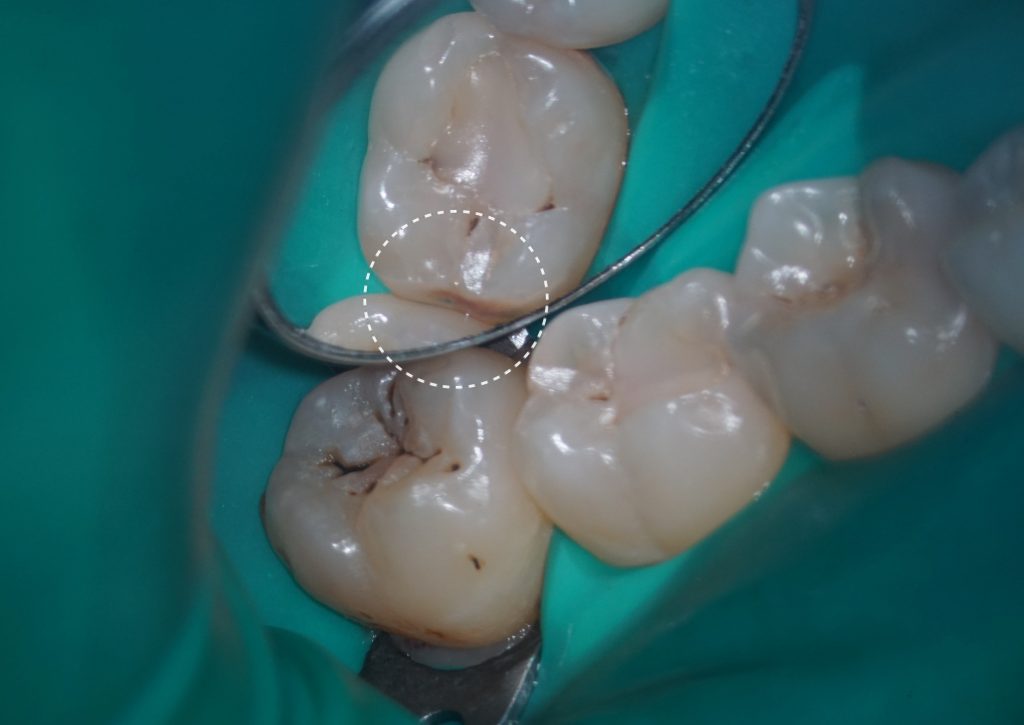 Рентгенологический отчет Diagnocat - особые возможности 14 Рентгенологический отчет Diagnocat - особые возможности 13