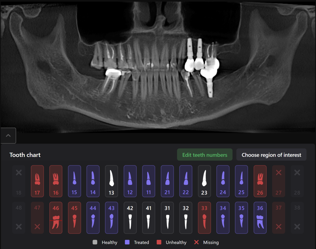 Implant placement using Diagnocat modules 18 Implant placement using Diagnocat modules 17
