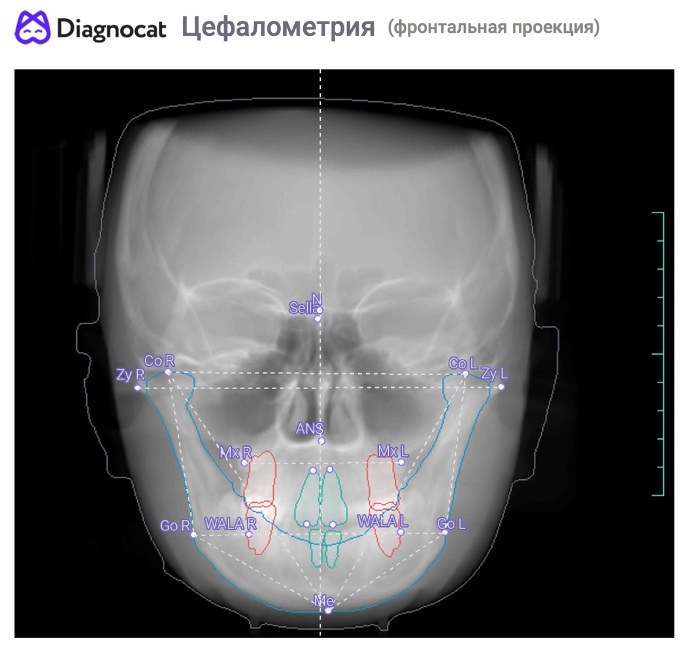 Ортодонтический отчёт 4 Ортодонтический отчёт 3