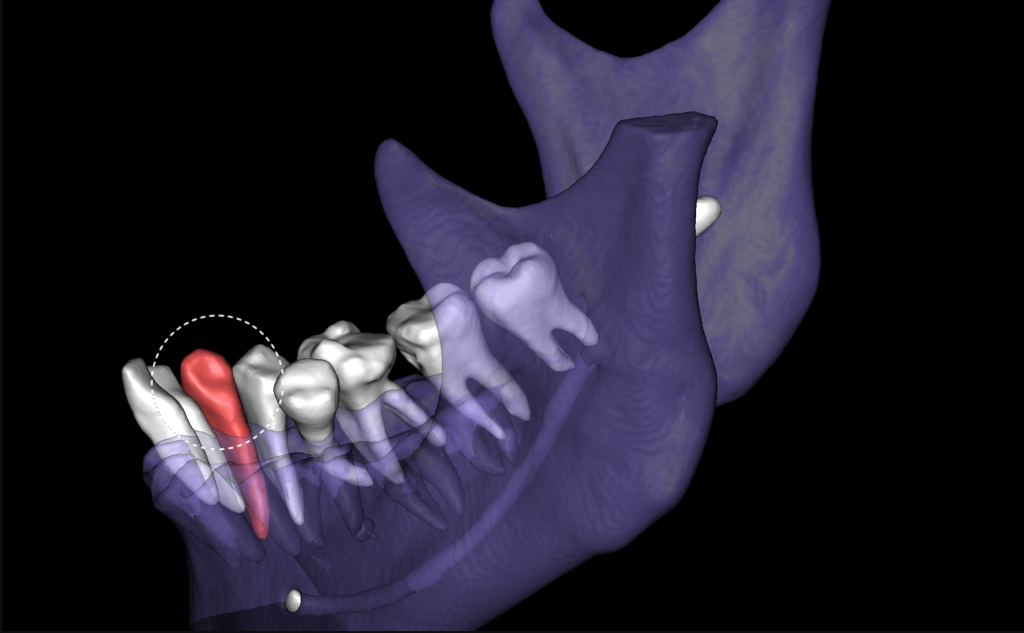 Artifact or true pathology? Let's see! 2 Artifact or true pathology? Let's see! 1