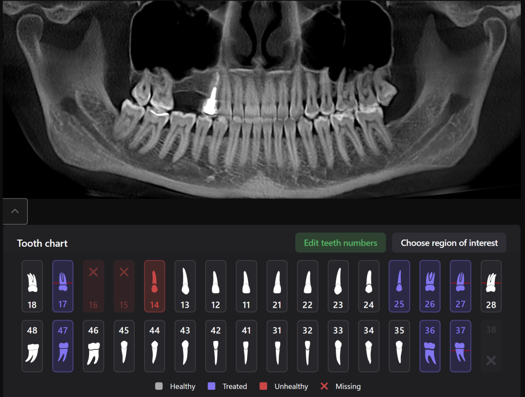 Planning guided implant surgery with Diagnocat 2 Planning guided implant surgery with Diagnocat 1