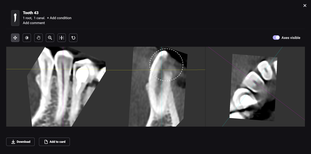 Artifact or true pathology? Let's see! 4 Artifact or true pathology? Let's see! 3