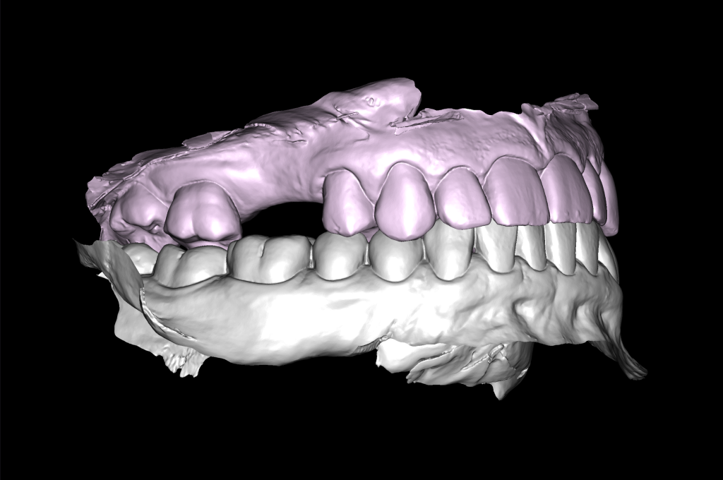 Planning guided implant surgery with Diagnocat 4 Planning guided implant surgery with Diagnocat 3