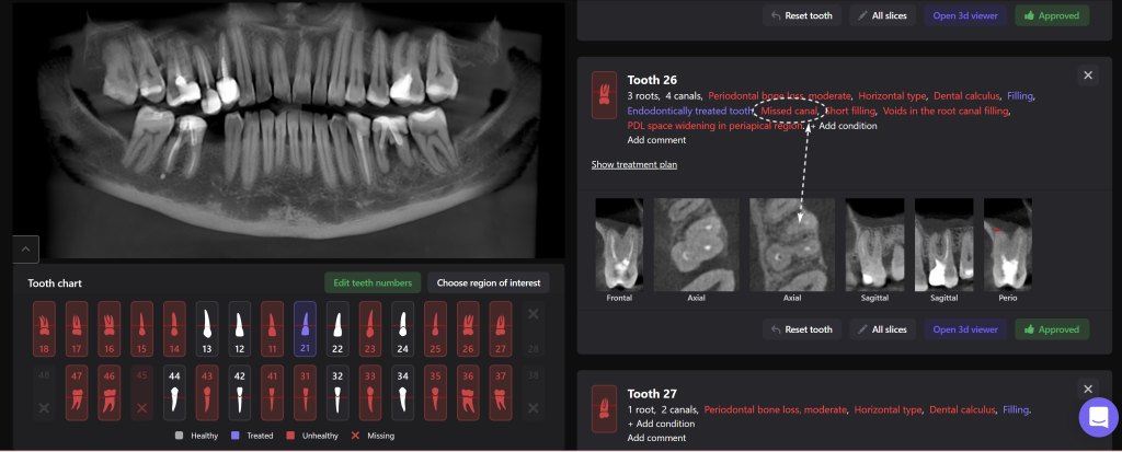 Study root canal morphology and anatomy with Diagnocat 4 Study root canal morphology and anatomy with Diagnocat 3