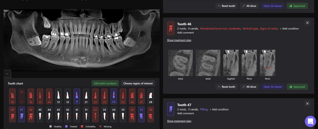 Treatment of severe periodontal disease 6 Treatment of severe periodontal disease 5
