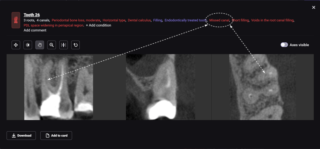 Study root canal morphology and anatomy with Diagnocat 6 Study root canal morphology and anatomy with Diagnocat 5