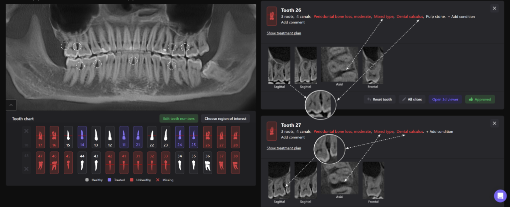 Timely periodontal screening with Diagnocat - the key to successful treatment result 6 Timely periodontal screening with Diagnocat - the key to successful treatment result 5