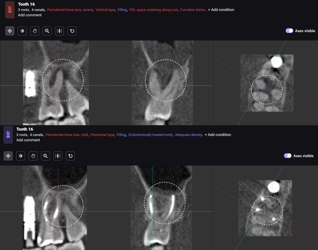 Which tool will help detect the initial signs of pathology? 8 Which tool will help detect the initial signs of pathology? 7