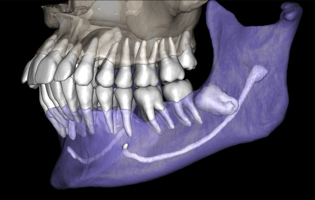 Treatment of severe periodontal disease 8 Treatment of severe periodontal disease 7