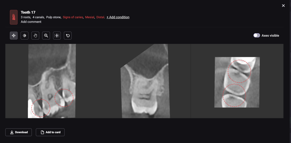 Artifact or true pathology? Let's see! 8 Artifact or true pathology? Let's see! 7