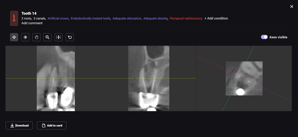 2D vs 3D (PANO vs CBCT) Who's gonna win? 8 2D vs 3D (PANO vs CBCT) Who's gonna win? 7