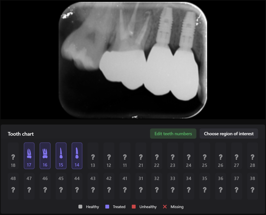 Planning implantation using Diagnocat AI 12 Planning implantation using Diagnocat AI 11