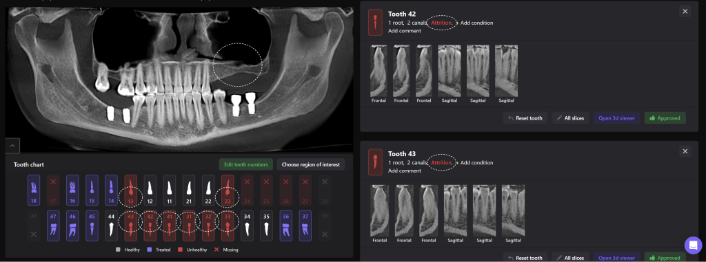 Implant planning together with the Diagnocat STL module 2 Implant planning together with the Diagnocat STL module 1