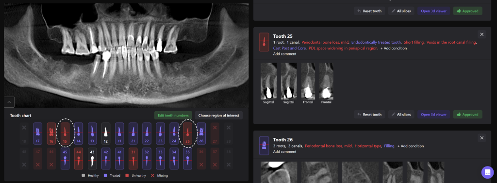 Simple Implant planning using the Diagnocat STL Module 2 Simple Implant planning using the Diagnocat STL Module 1