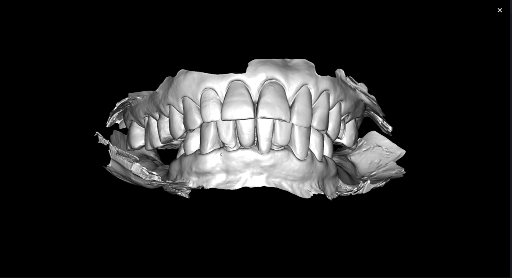Simple Implant planning using the Diagnocat STL Module 4 Simple Implant planning using the Diagnocat STL Module 3