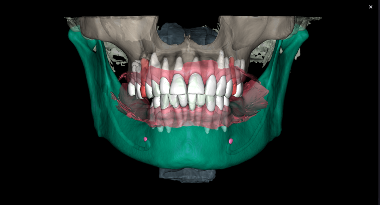 The projection of the jaw