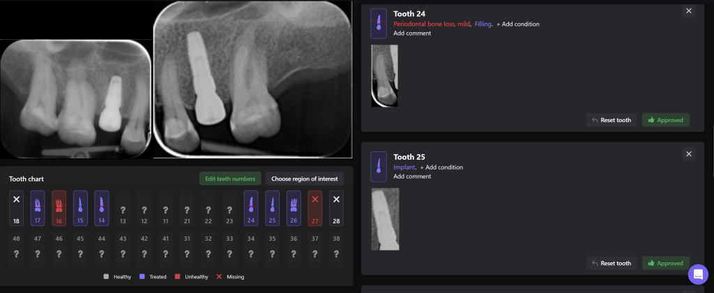 Simple Implant planning using the Diagnocat STL Module 8 Simple Implant planning using the Diagnocat STL Module 7