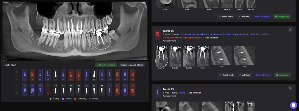 Diagnosis of frequent endodontic complications with Diagnocat 8 Diagnosis of frequent endodontic complications with Diagnocat 7